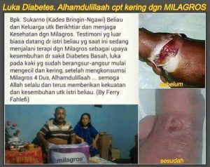 diabetes kering 1 sembuh oleh milagros