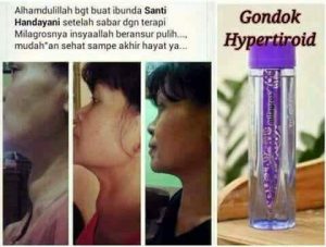 thyroid 4 sembuh oleh air milagros